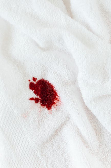 Close-up of a white fabric surface, possibly bed linen or cloth towel, with a noticeable bloodstain in the center. The stain appears fresh and irregular in shape, with some smaller splatters around it. The fabric shows no signs of additional dirt or debris, and the lighting highlights the contrast between the red blood and the white material. This image emphasizes the importance of proper surface cleaning and spot removal techniques in residential or commercial settings. Holland Park Carpet Cleaning specializes in stain removal mistakes landlords see in Holland Park, offering expert advice on effective surface cleaning and sanitisation to maintain hygiene and appearance. The scene is set in a well-lit environment, focusing on the cleanliness and condition of the fabric surface, suitable for illustrating the need for professional stain removal and deep cleaning processes.